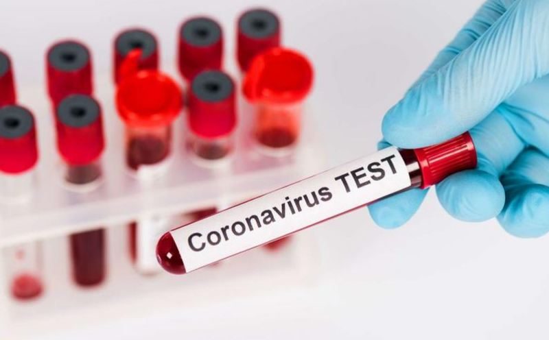 Өңірде бүгін коронавирус инфекциясын жұқтырған тағы 1 адам анықталды