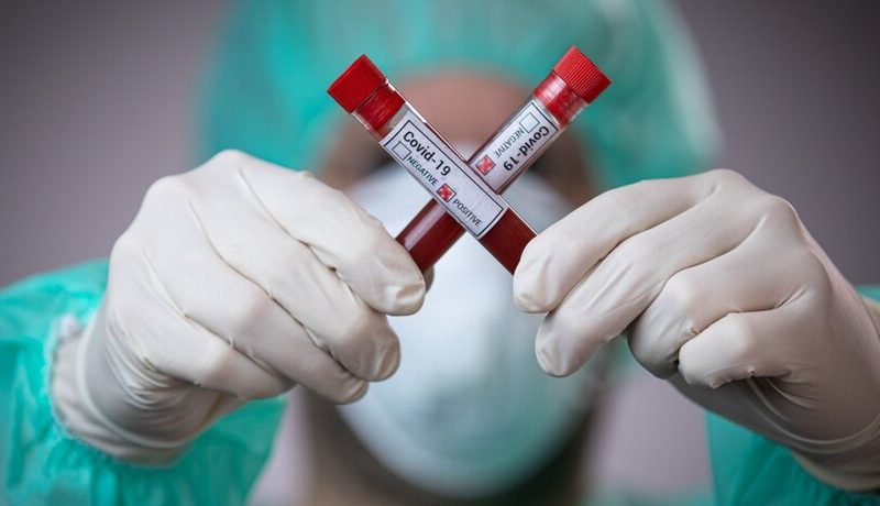 Алматы облысында коронавирус инфекциясын жұқтырған 7 адам  тіркелді